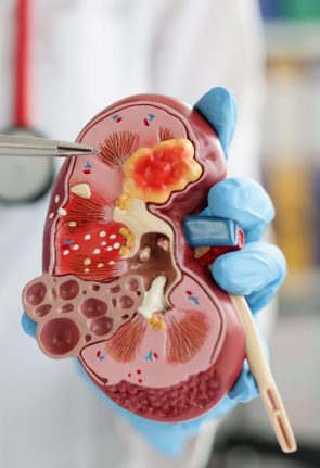 urologist-pointing-pen-kidney-structure-anatomical-model.jpg
